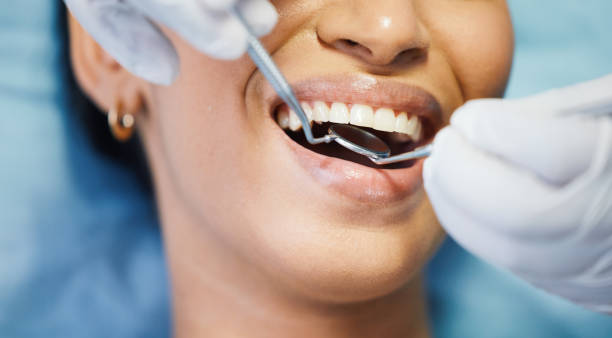 Best Emergency Dental Care for Broken or Chipped Teeth in Maili, HI